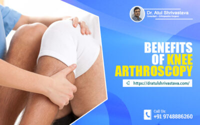 Benefits of Knee Arthroscopy