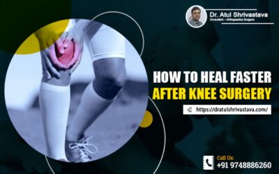 How to Heal Faster After Knee Surgery