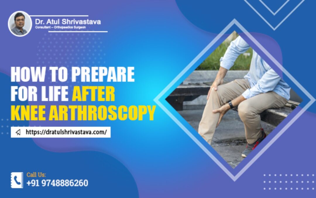 How to Prepare for Life after Knee Arthroscopy