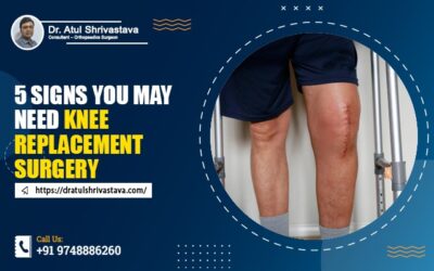 5 Signs You May Need Knee Replacement Surgery