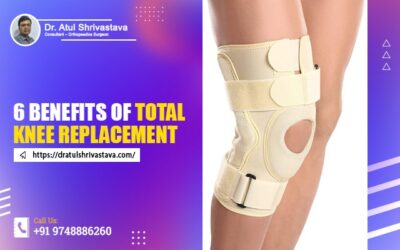 6 Benefits of Total Knee Replacement