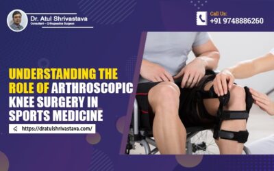 Understanding the Role of Arthroscopic Knee Surgery in Sports Medicine