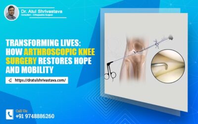 Transforming lives: How arthroscopic knee surgery restores hope and mobility