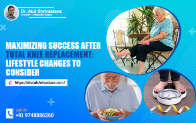 Maximizing success after total knee replacement: Lifestyle changes to consider