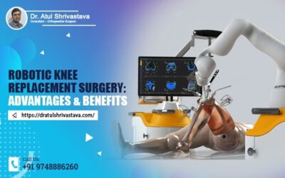 Robotic Knee Replacement Surgery: Advantages and Benefits