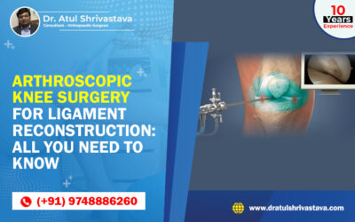 Arthroscopic Knee Surgery for Ligament Reconstruction: All You Need to Know