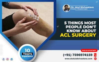 5 Things Most People Don’t Know About ACL Surgery