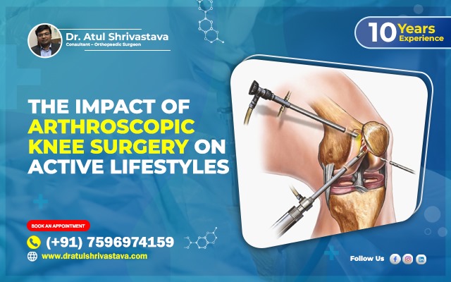 The Impact of Arthroscopic Knee Surgery on Active Lifestyles