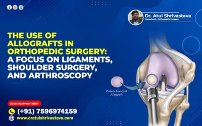 The Use of Allografts in Orthopedic Surgery: A Focus on Ligaments, Shoulder Surgery, and Arthroscopy