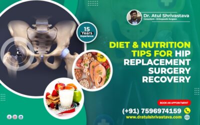 Diet and Nutrition Tips for Hip Replacement Surgery Recovery