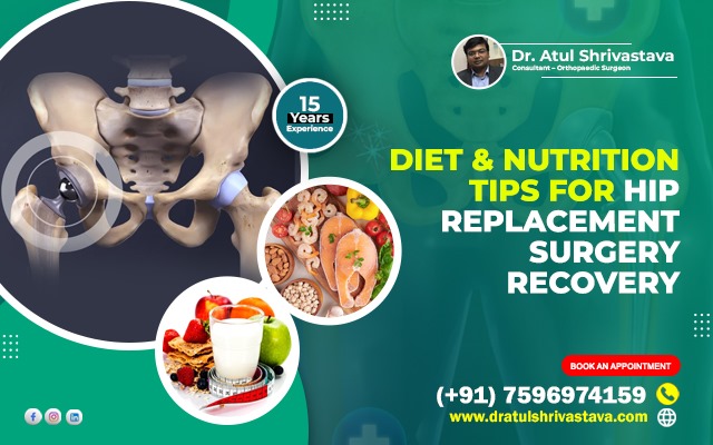 Diet and Nutrition Tips for Hip Replacement Surgery Recovery