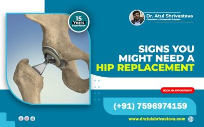 Signs You Might Need a Hip Replacement