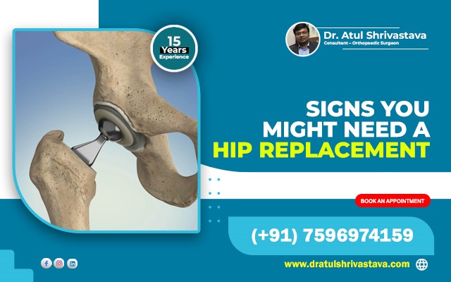 Signs You Might Need a Hip Replacement